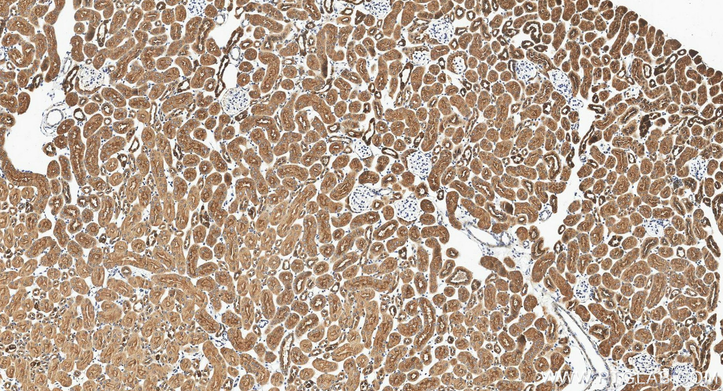 IHC staining of mouse kidney using 17725-1-AP