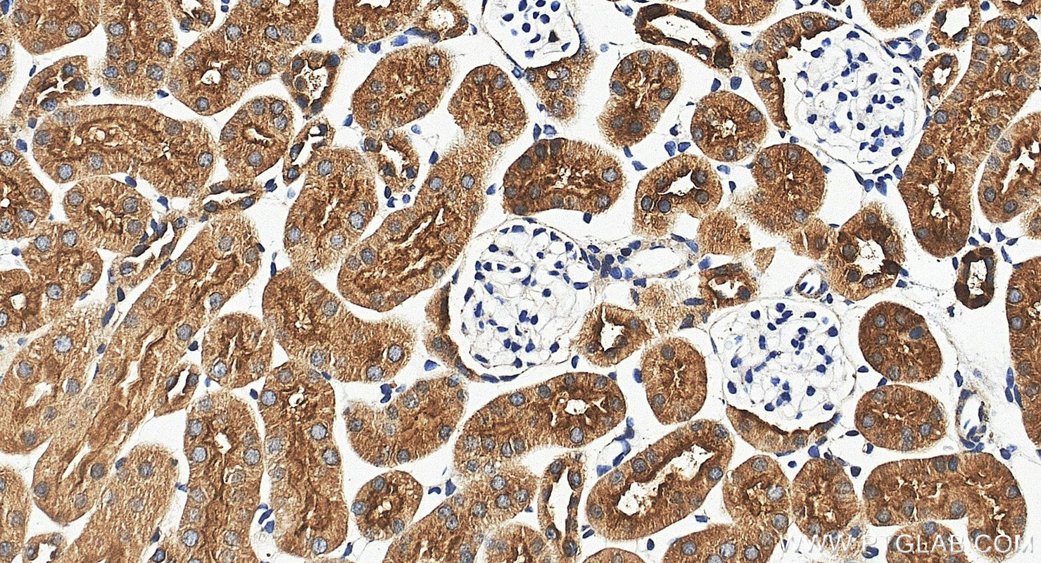 IHC staining of mouse kidney using 17725-1-AP