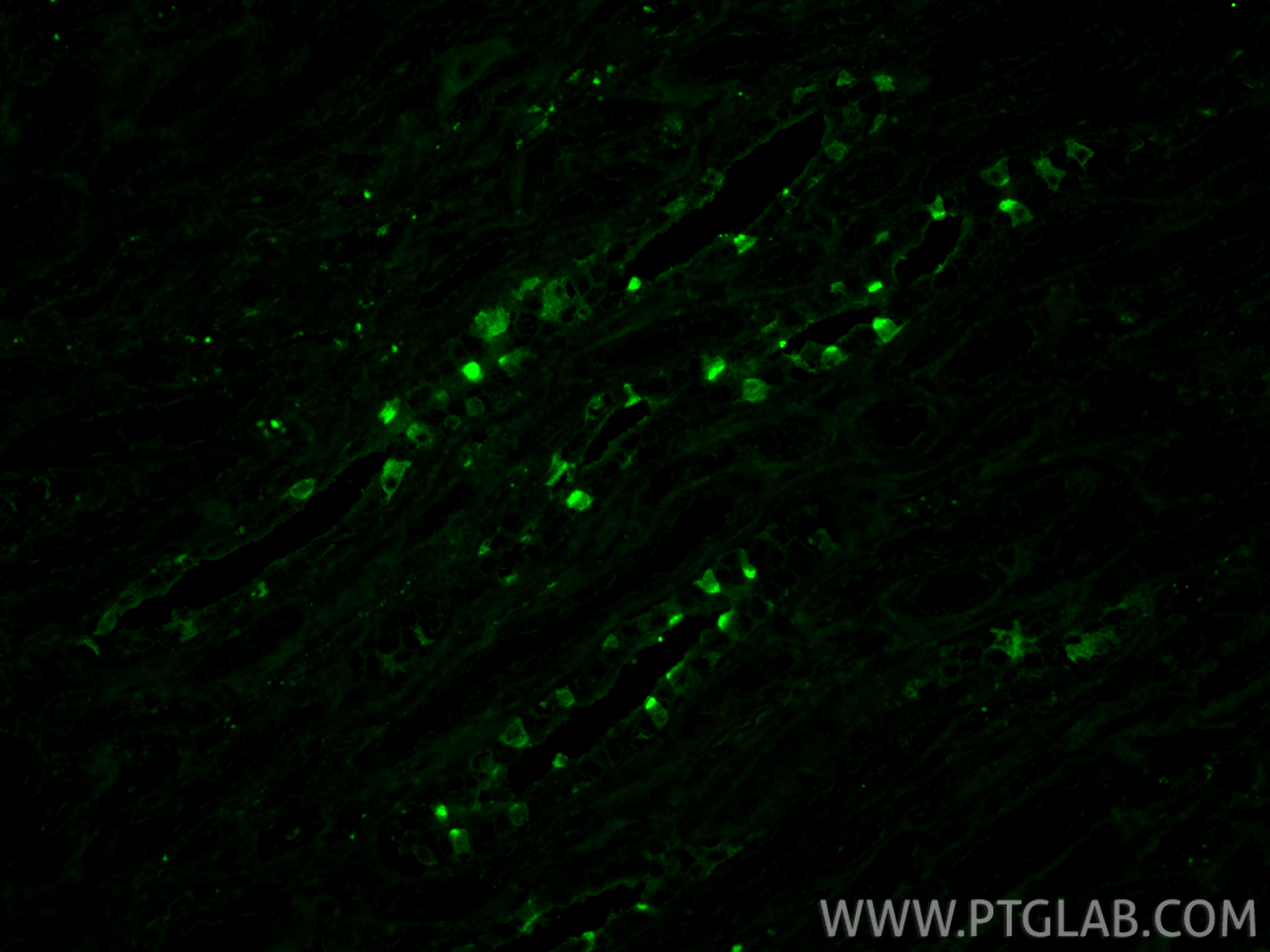IF Staining of human kidney using 87157-1-RR