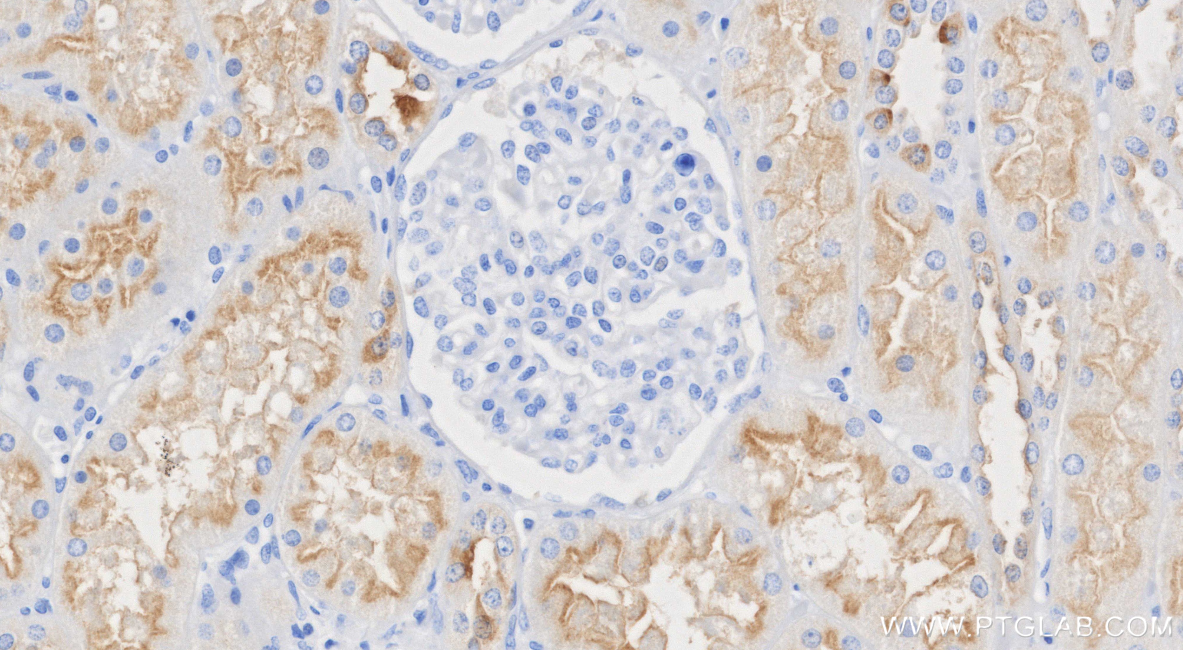 IHC staining of human kidney using 87157-1-RR