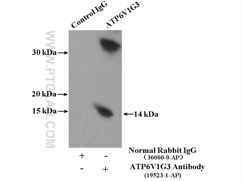 IP experiment of mouse kidney using 19523-1-AP