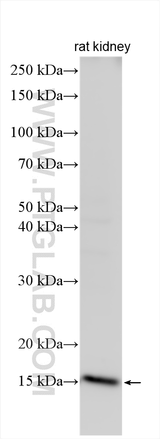 WB analysis using 19523-1-AP WB analysis using 19523-1-AP