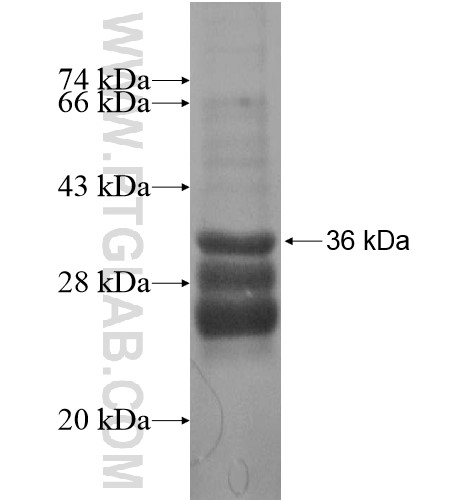 ATP6V1G3 fusion protein Ag16007 SDS-PAGE ATP6V1G3 fusion protein Ag16007 SDS-PAGE