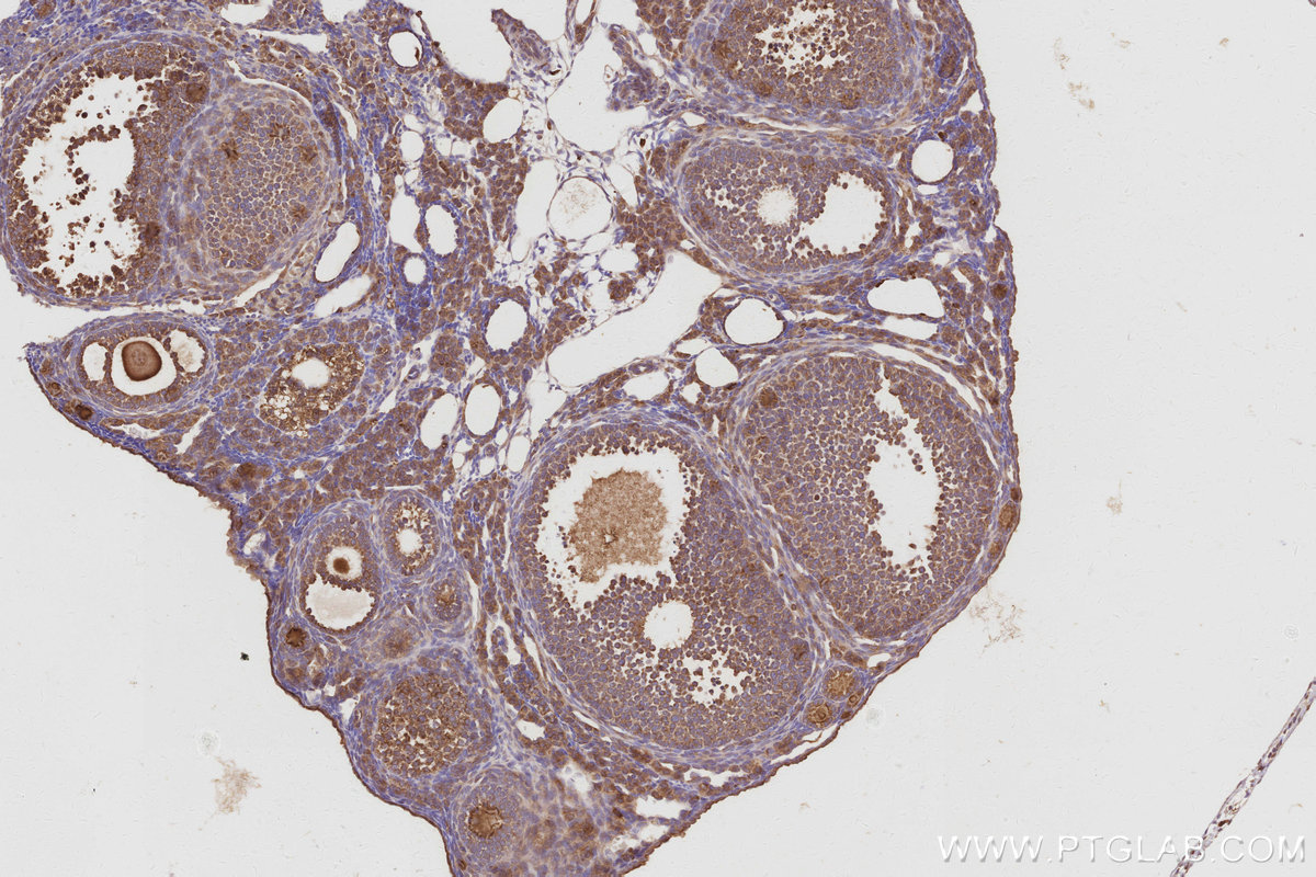 IHC staining of mouse ovary using 68425-1-Ig IHC staining of mouse ovary using 68425-1-Ig