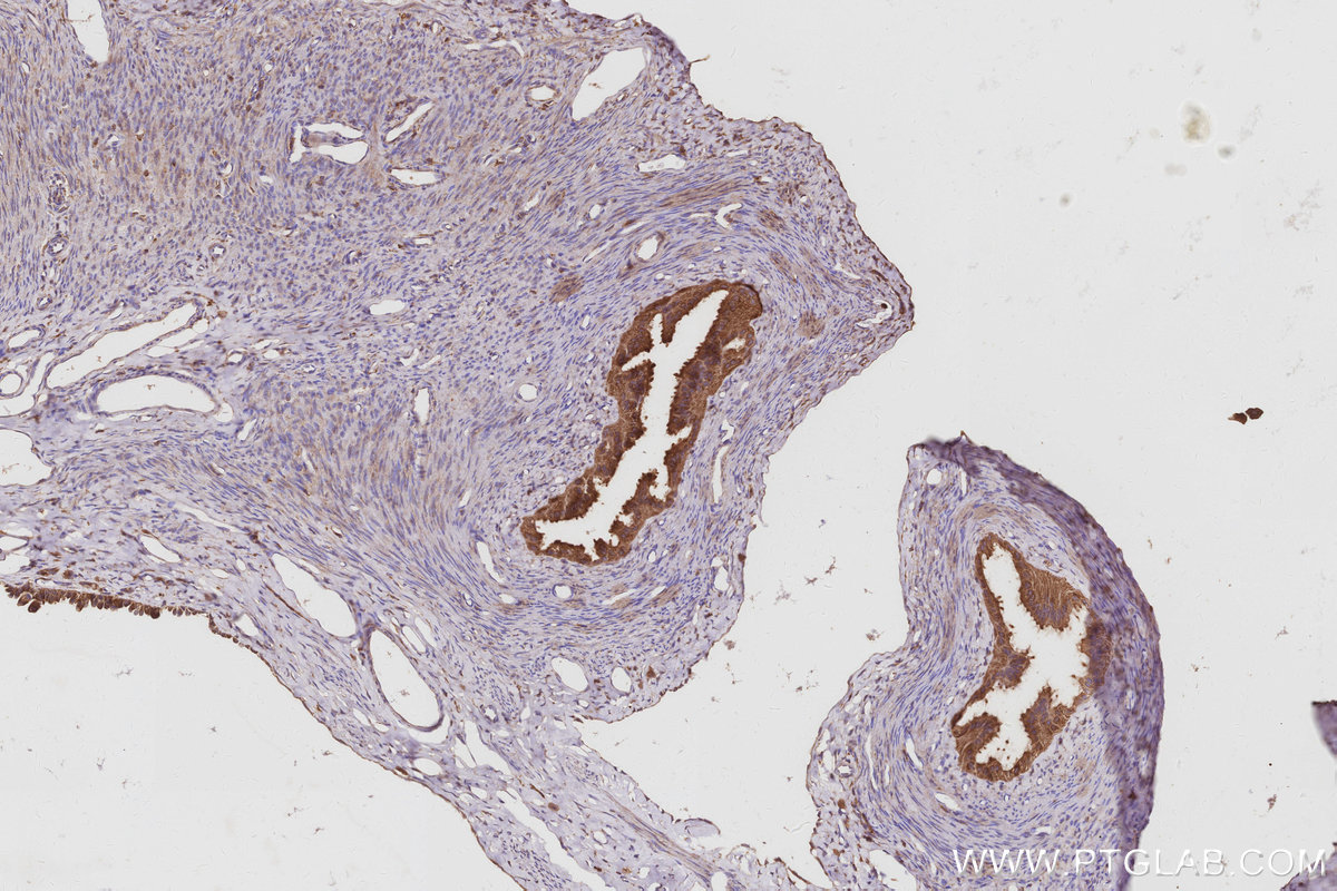 IHC staining of rat ovary using 68425-1-Ig IHC staining of rat ovary using 68425-1-Ig