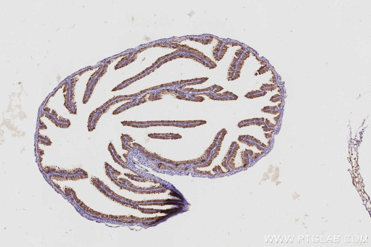 IHC staining of mouse ovary using 68425-1-Ig IHC staining of mouse ovary using 68425-1-Ig