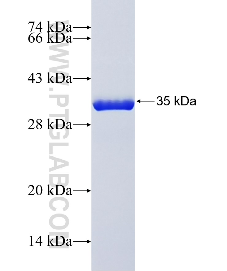 ATP7A fusion protein Ag41320 SDS-PAGE ATP7A fusion protein Ag41320 SDS-PAGE