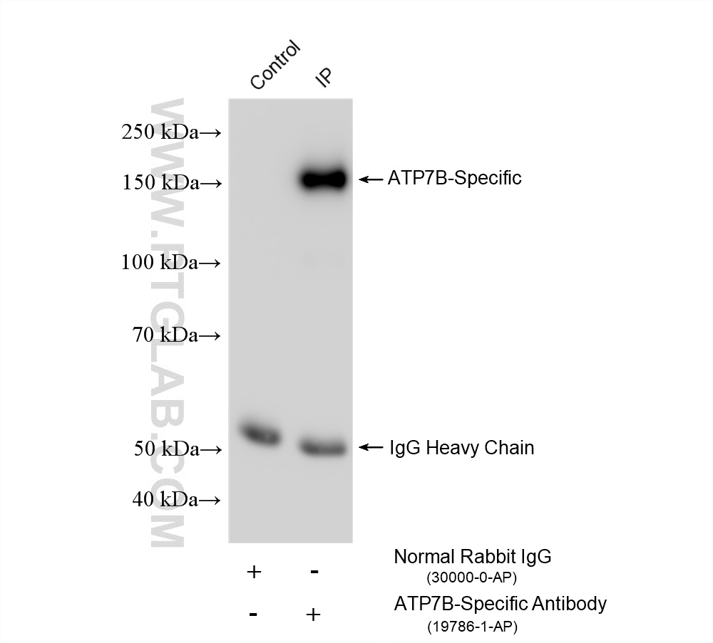 IP experiment of Caco-2 using 19786-1-AP