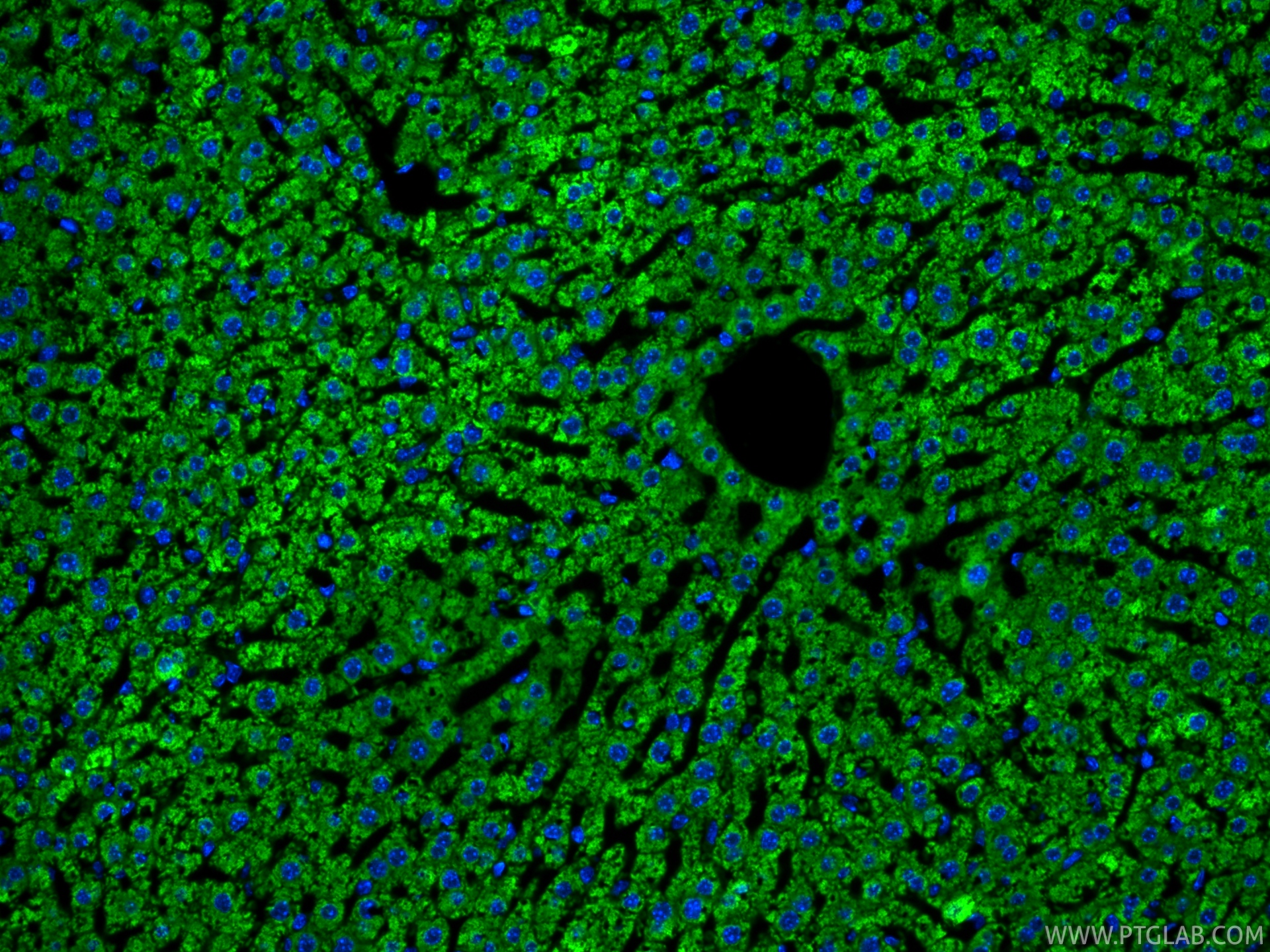 Immunofluorescent analysis of (4% PFA) fixed paraffin-embedded mouse liver tissue using CoraLite® Plus 488 ATP7B-Specific antibody (CL488-85288-2, Clone: 242827B3 ) at dilution of 1:200. Heat mediated antigen retrieval with Tris-EDTA buffer (pH 9.0). IF Staining of mouse liver using CL488-85288-2
