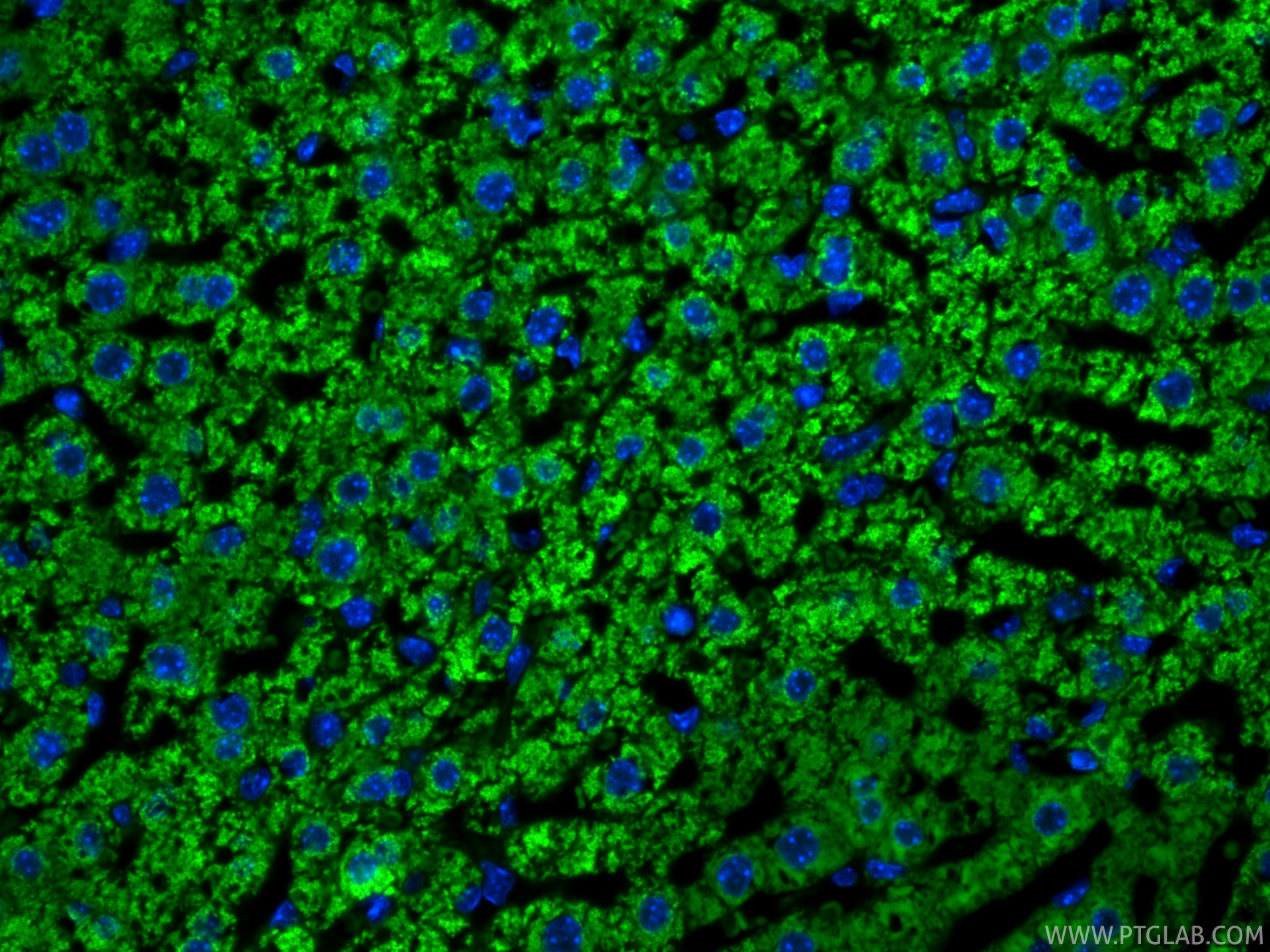 Immunofluorescent analysis of (4% PFA) fixed paraffin-embedded mouse liver tissue using CoraLite® Plus 488 ATP7B-Specific antibody (CL488-85288-2, Clone: 242827B3 ) at dilution of 1:200. Heat mediated antigen retrieval with Tris-EDTA buffer (pH 9.0). IF Staining of mouse liver using CL488-85288-2