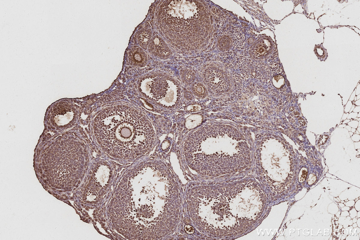 IHC staining of mouse ovary using 21565-1-AP IHC staining of mouse ovary using 21565-1-AP