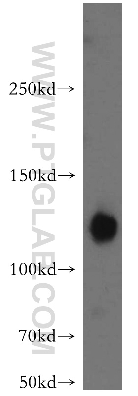 WB analysis of mouse brain using 21565-1-AP