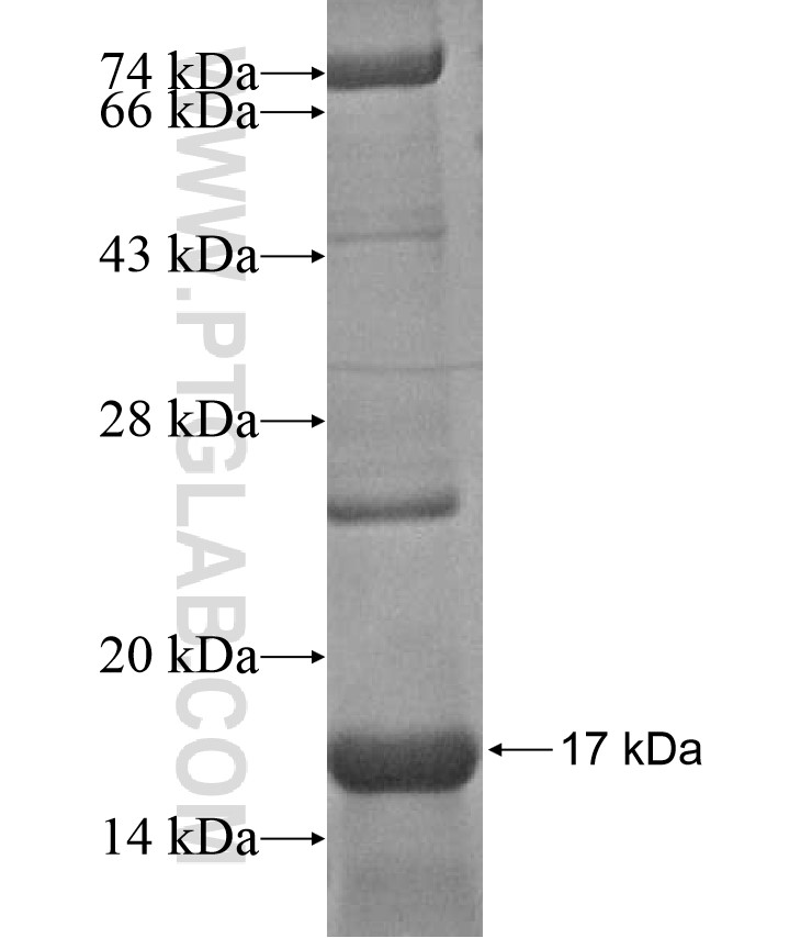 ATP8A1 fusion protein Ag17346 SDS-PAGE ATP8A1 fusion protein Ag17346 SDS-PAGE