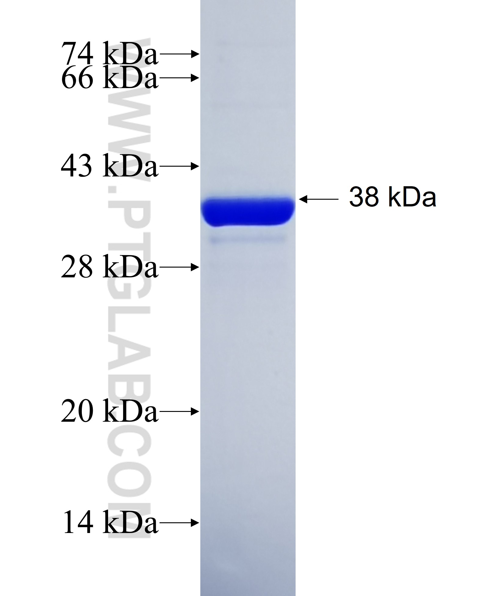 ATP8A2 fusion protein Ag36276 SDS-PAGE