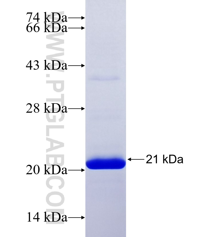 ATP8A2 fusion protein Ag36535 SDS-PAGE