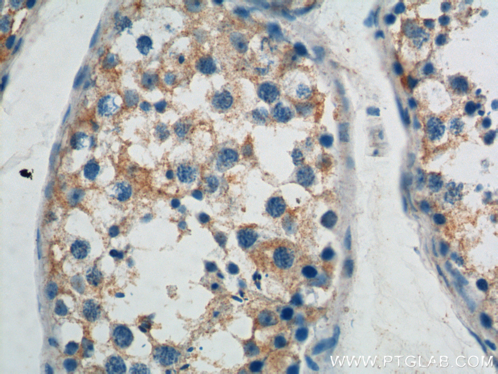 IHC staining of human testis using 19504-1-AP