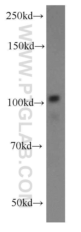 WB analysis of mouse spleen using 19504-1-AP