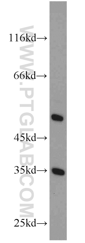 WB analysis of L02 using 15797-1-AP