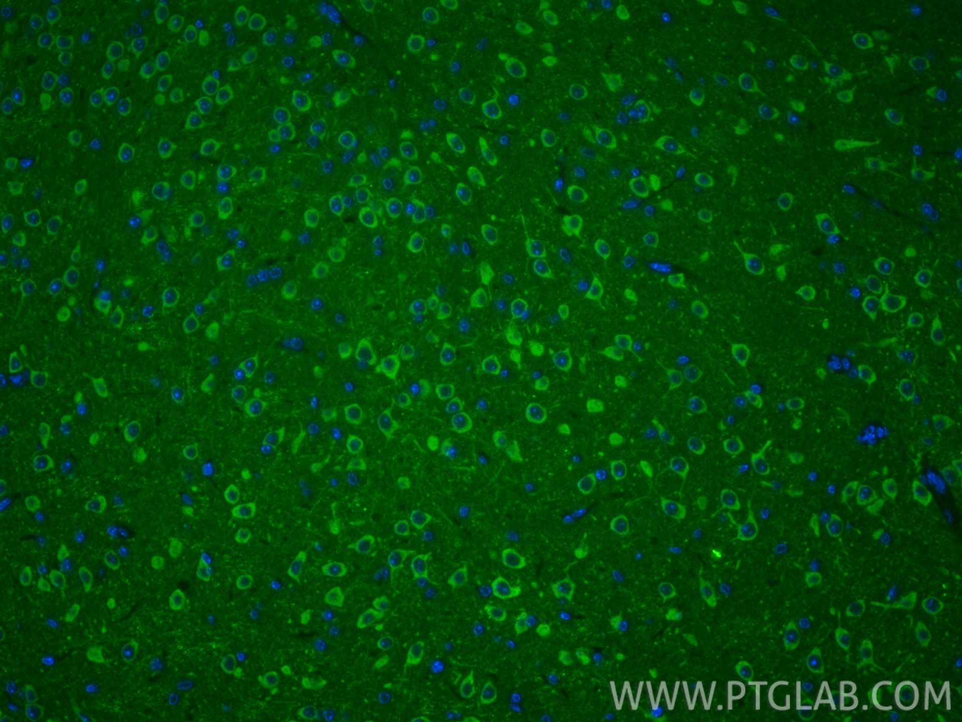 IF Staining of mouse brain using 18016-1-AP