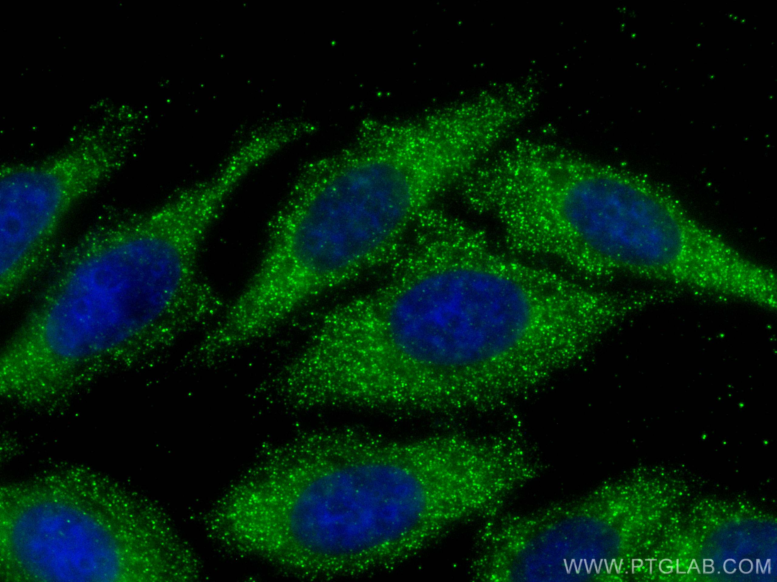 IF Staining of HepG2 using 68351-1-Ig (same clone as 68351-1-PBS)