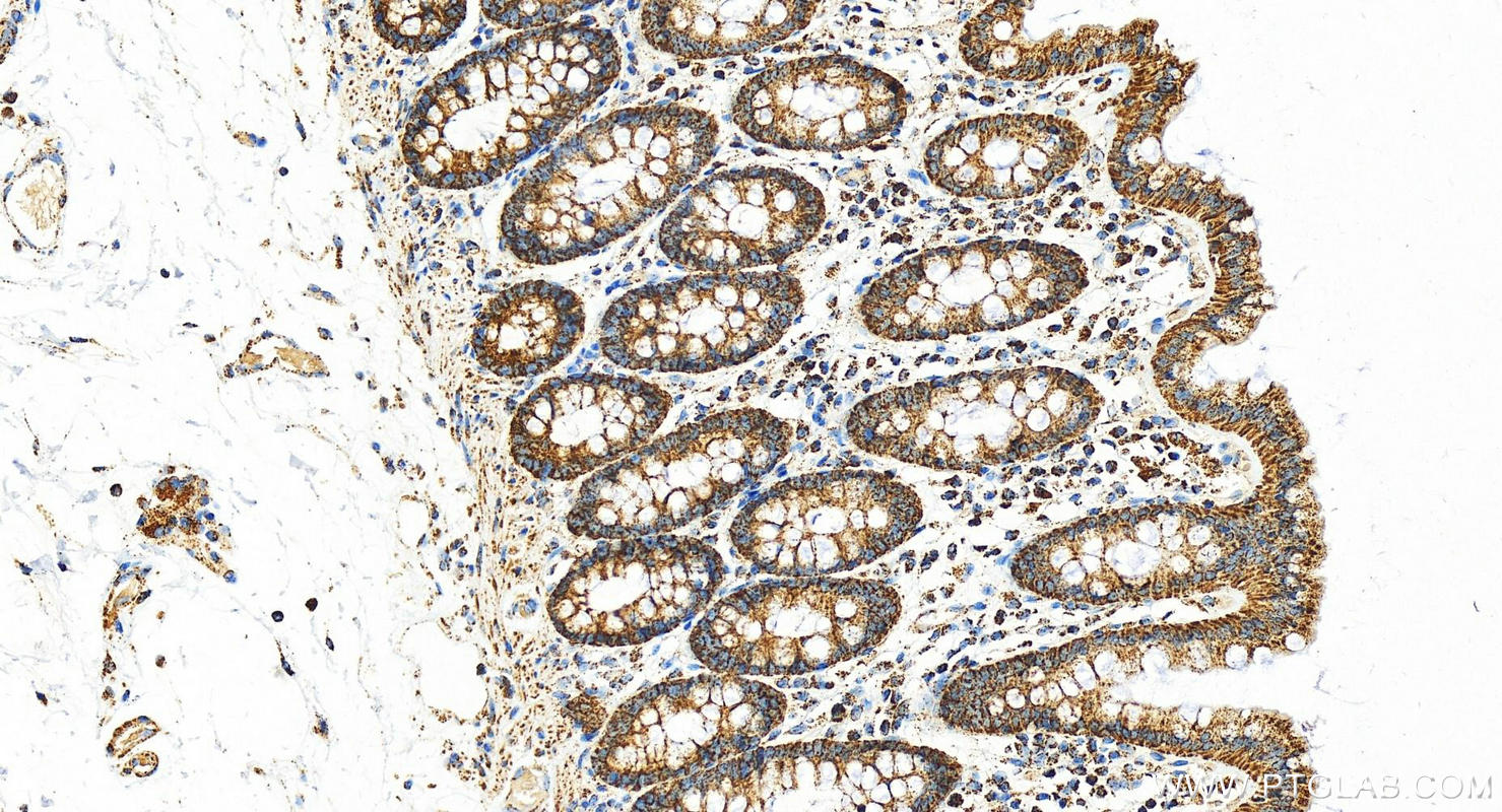 IHC staining of human  colon using 17247-1-AP