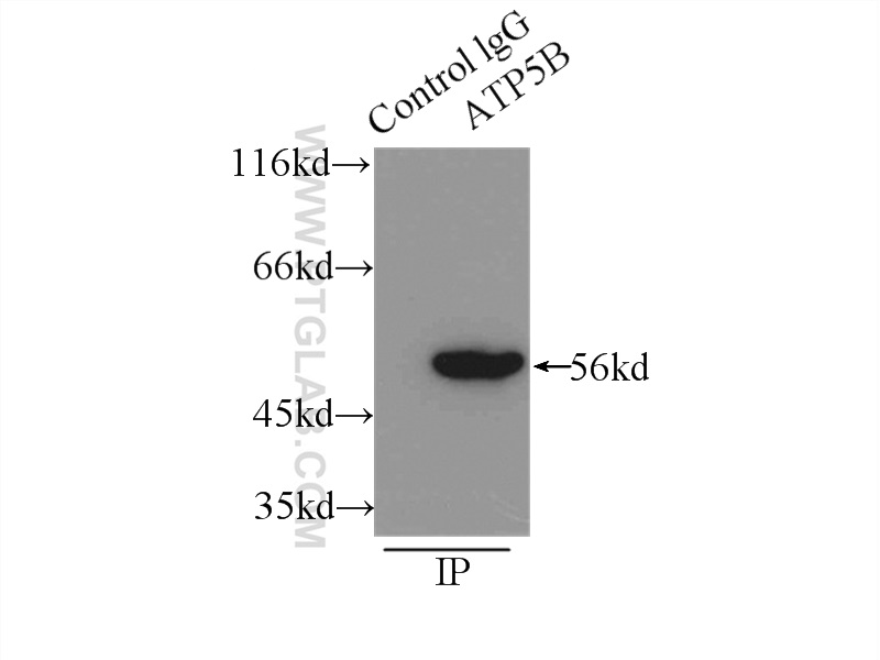 IP experiment of mouse heart using 17247-1-AP