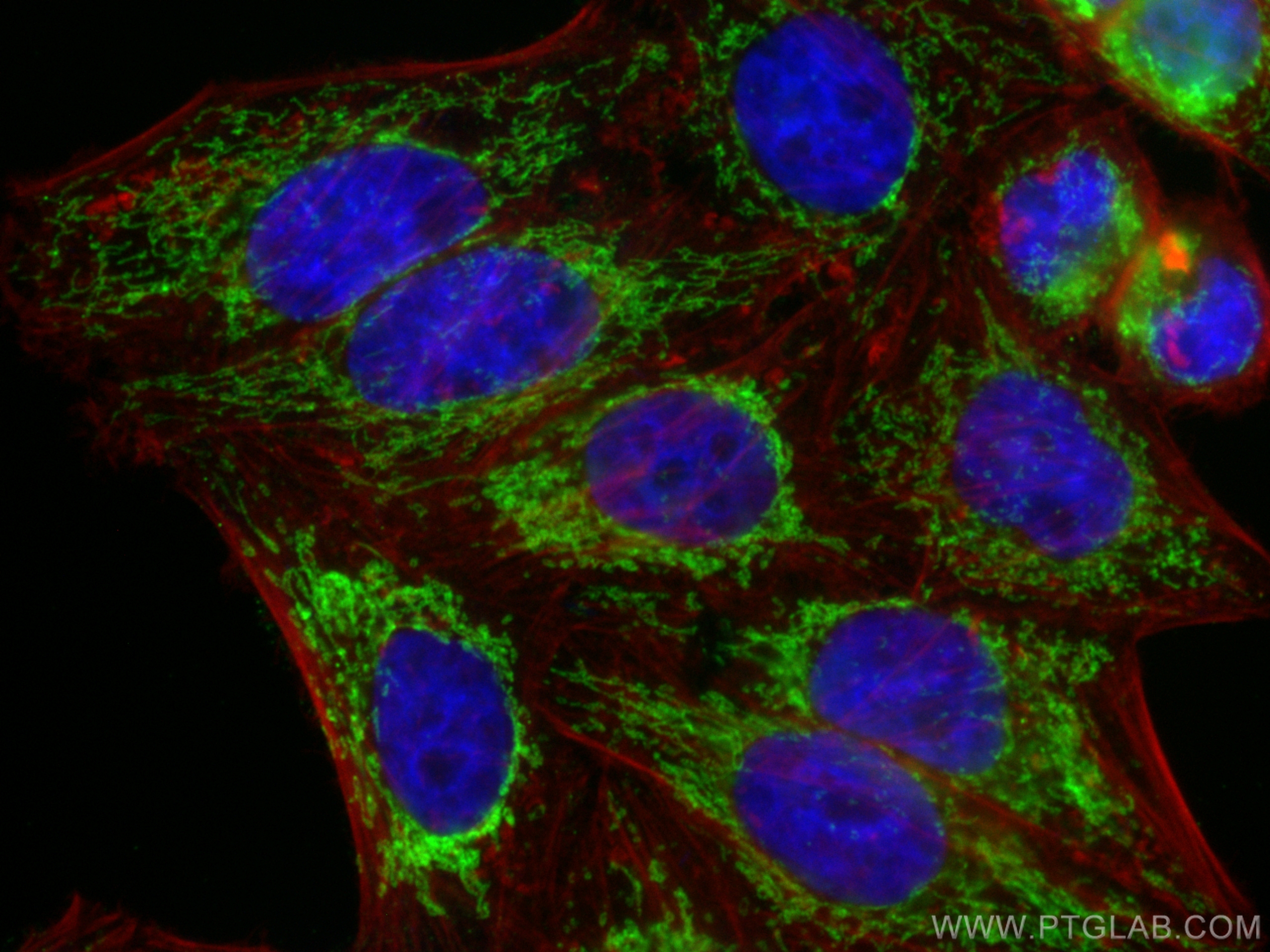 IF Staining of HepG2 using 66600-1-Ig