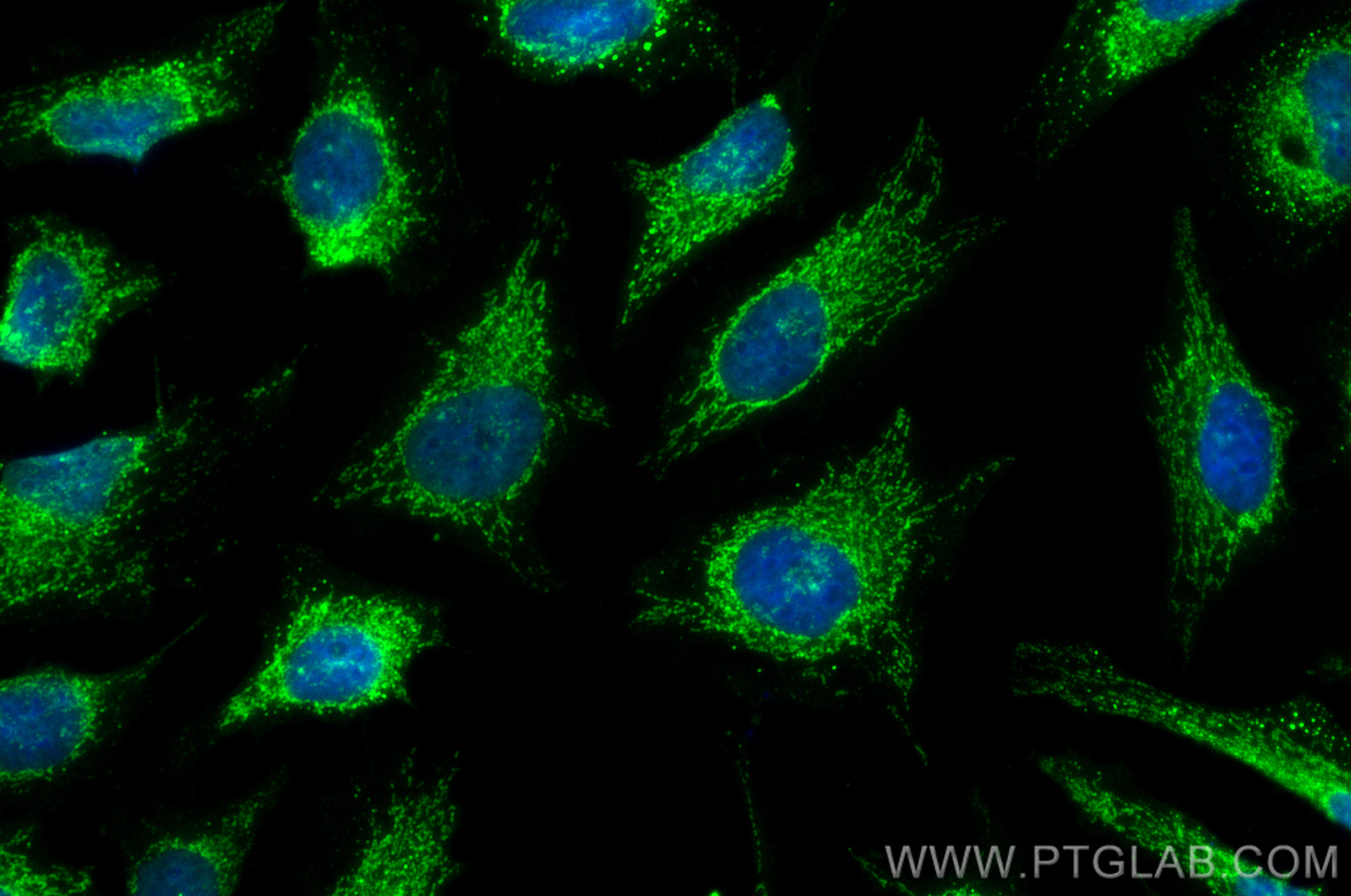 IF Staining of HeLa using CL488-17247