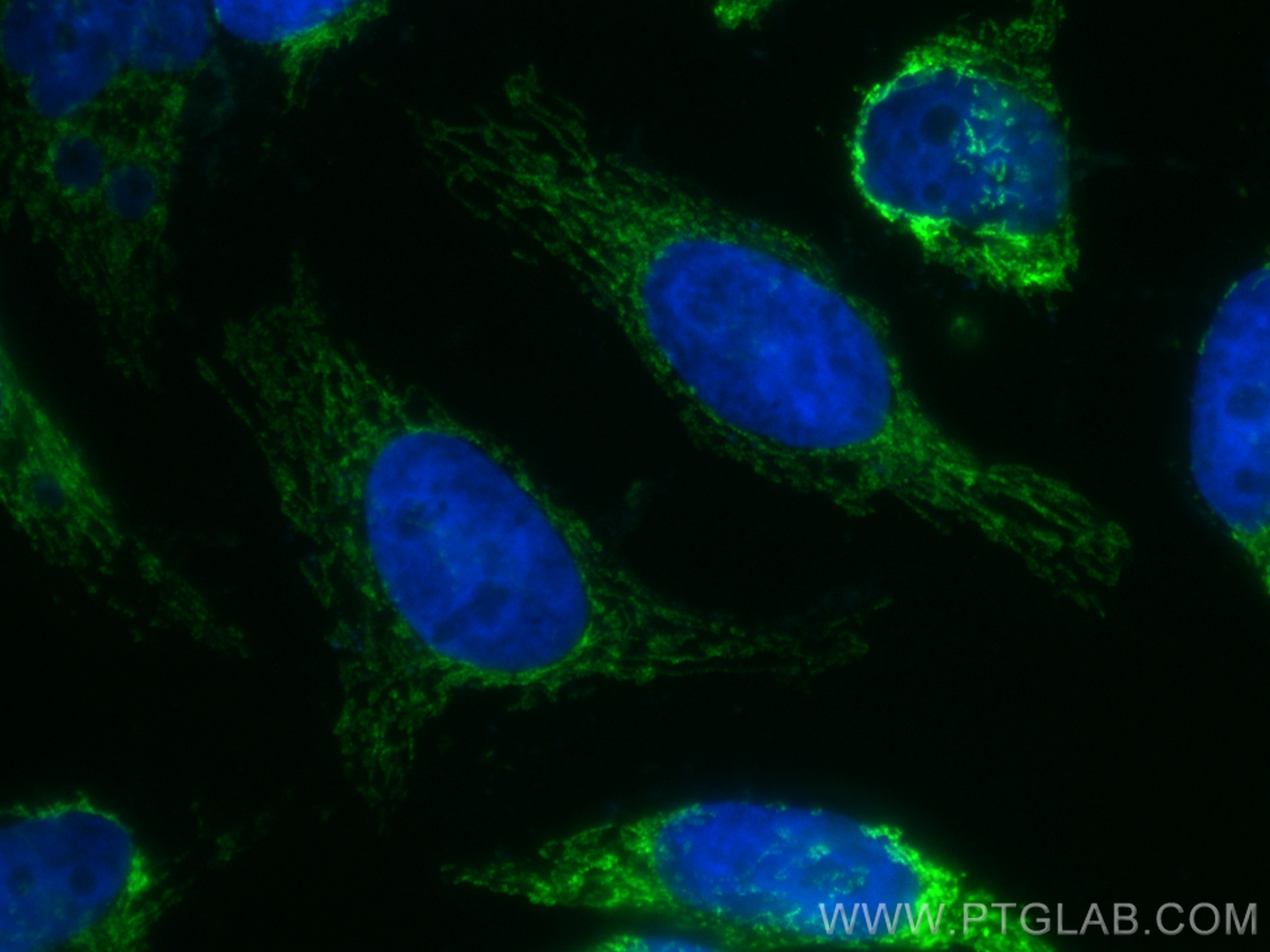IF Staining of HeLa using CL488-66600