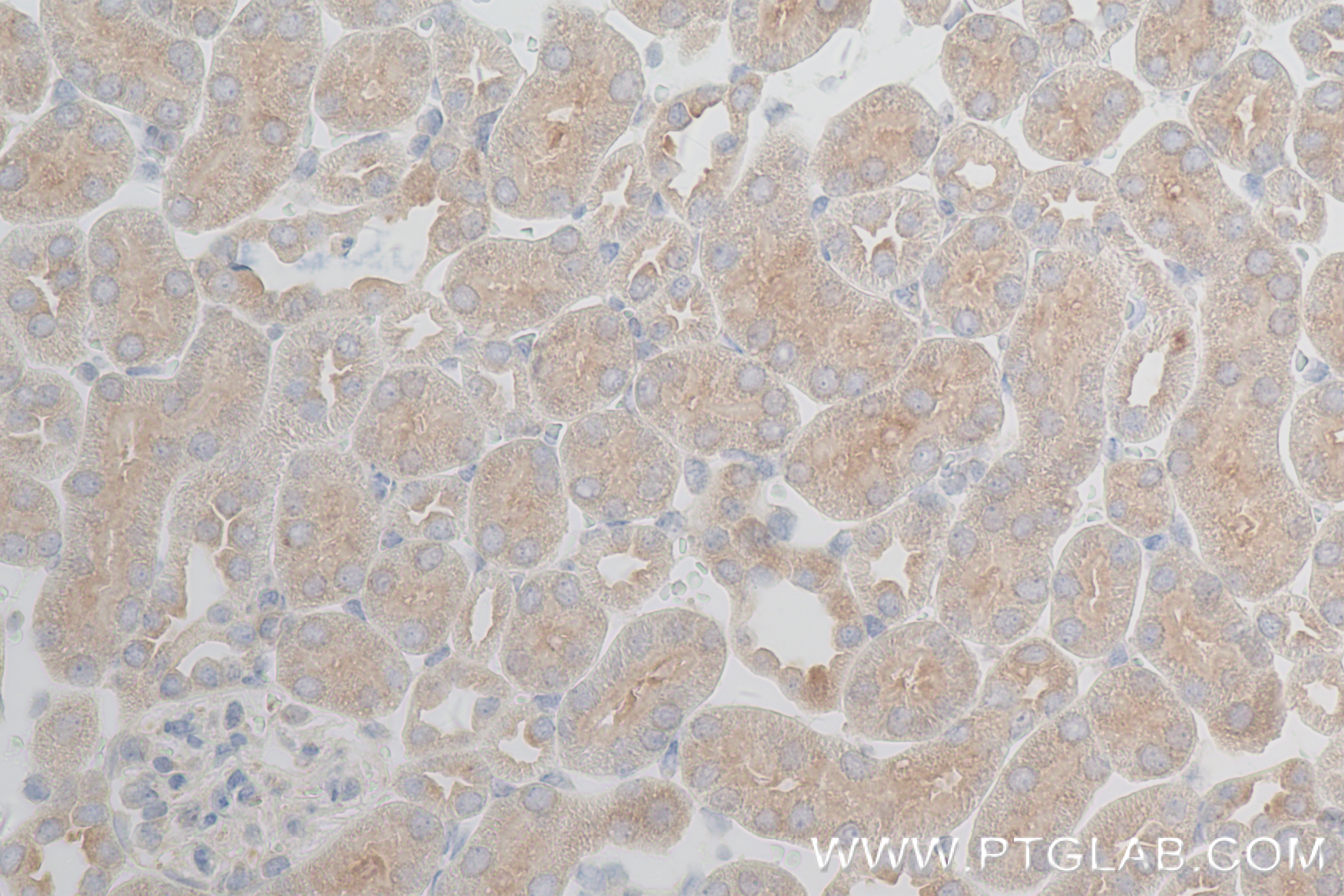 IHC staining of mouse kidney using 84318-4-RR (same clone as 84318-4-PBS)