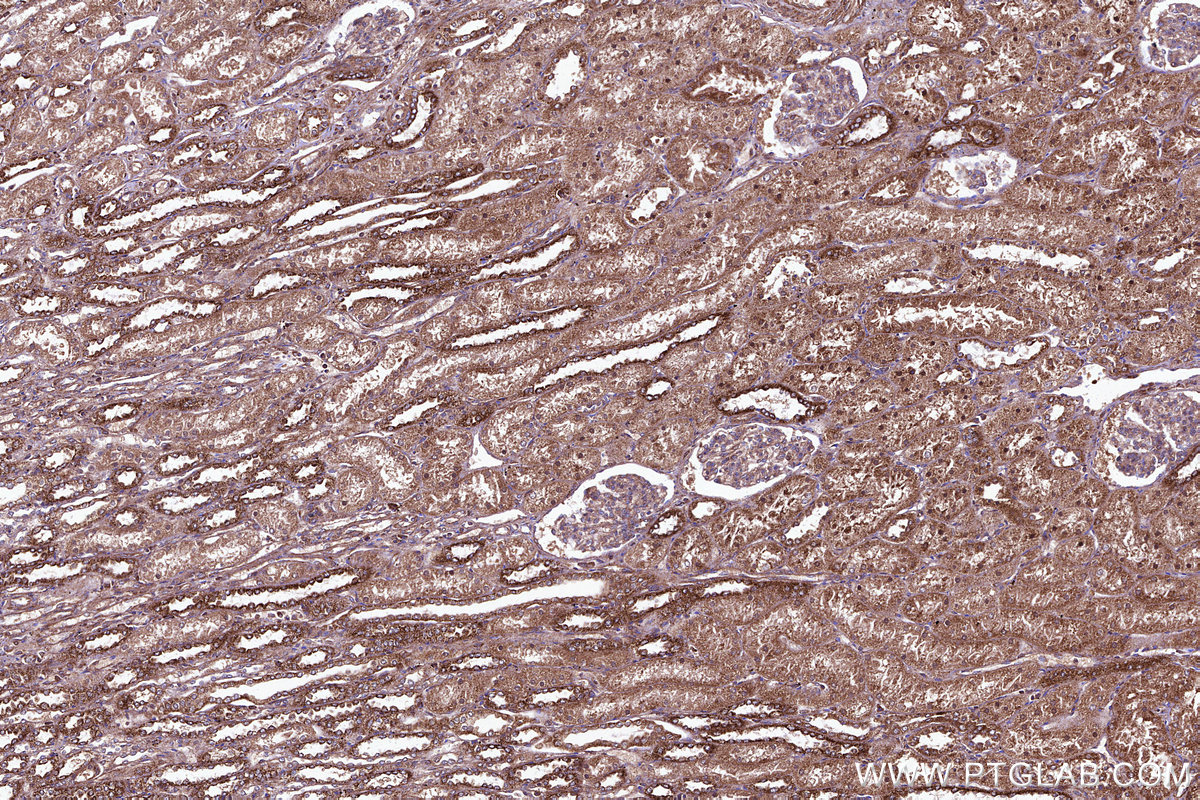 IHC staining of human kidney using 84318-4-RR IHC staining of human kidney using 84318-4-RR