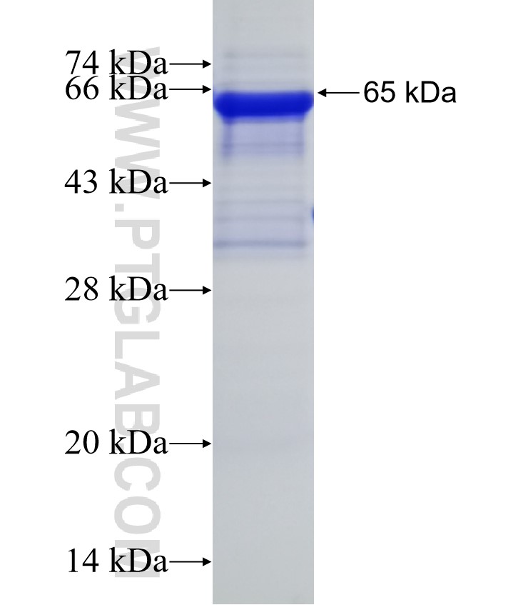 ATPGD1 fusion protein Ag22761 SDS-PAGE