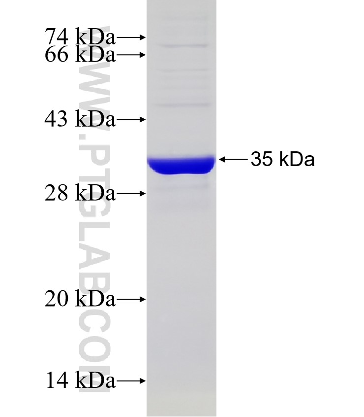 ATPGD1 fusion protein Ag32724 SDS-PAGE ATPGD1 fusion protein Ag32724 SDS-PAGE