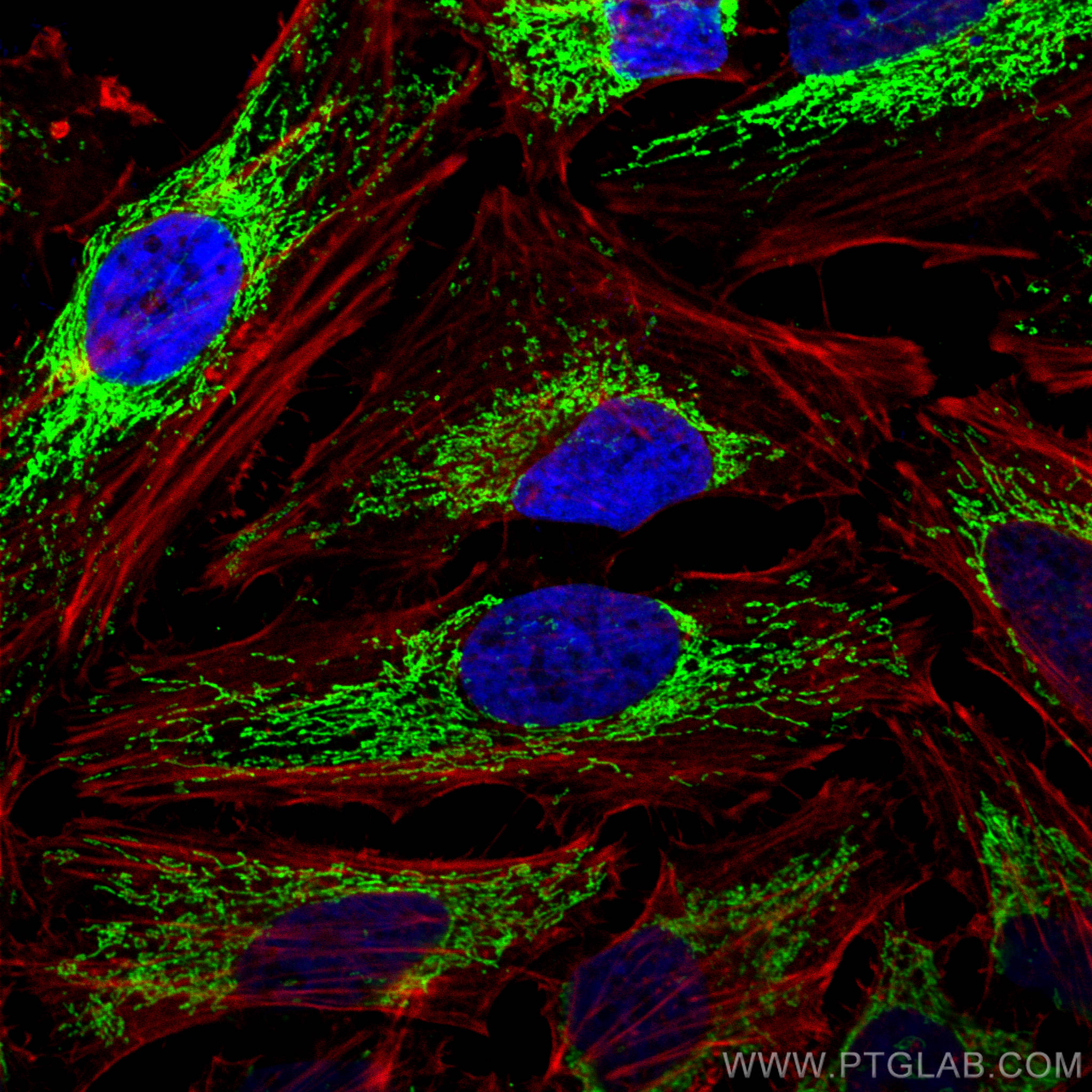 Immunofluorescent analysis of (4% PFA) fixed HeLa cells using ATPIF1 antibody (12067-1-AP) at dilution of 1:200 and CoraLite®488-Conjugated AffiniPure Goat Anti-Rabbit IgG(H+L), CL594-Phalloidin (red). IF Staining of HeLa using 12067-1-AP
