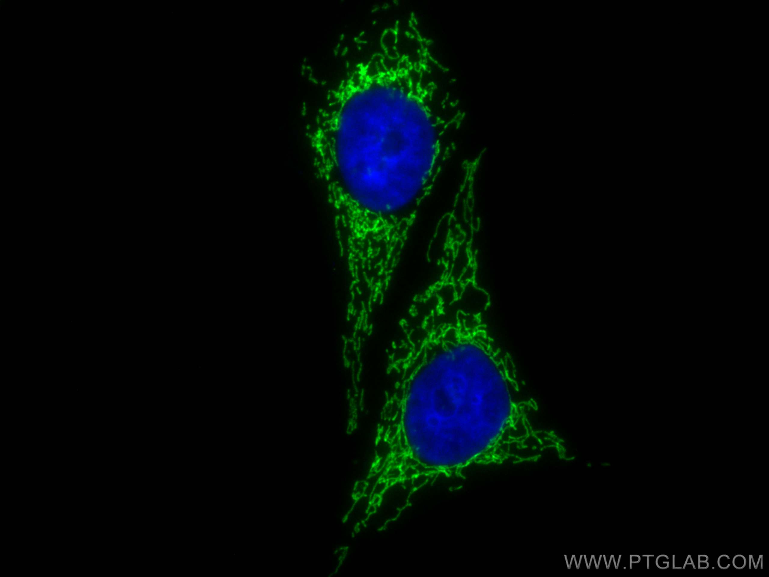 IF Staining of HepG2 using CL488-12067