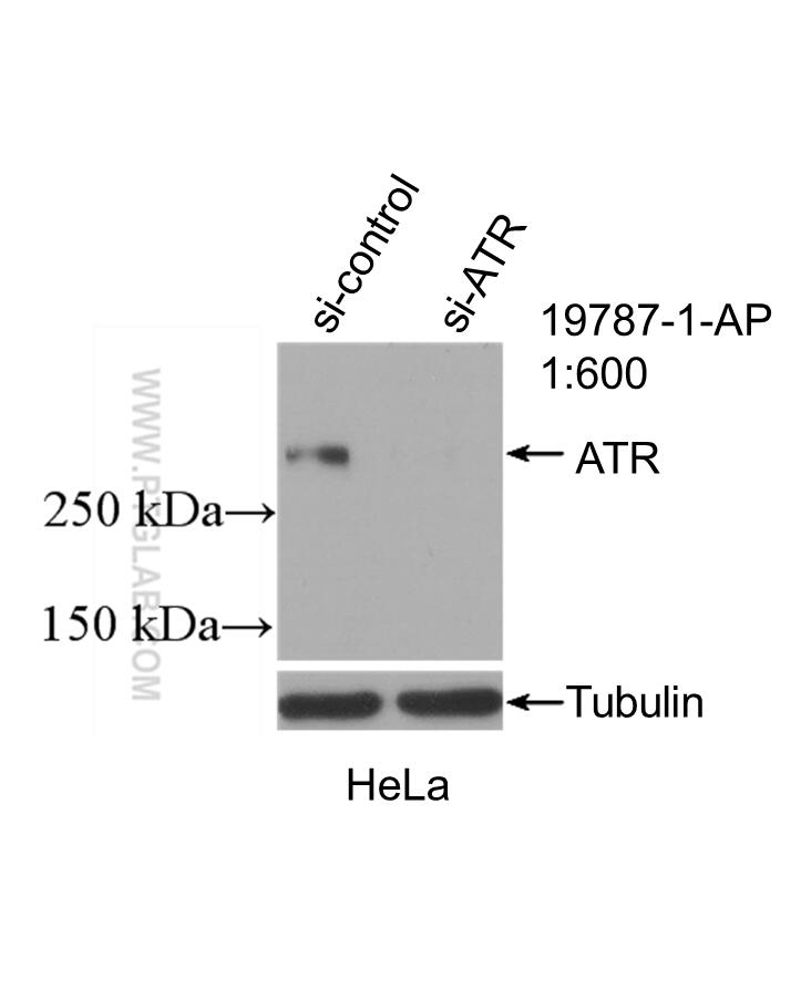 WB analysis of HeLa using 19787-1-AP