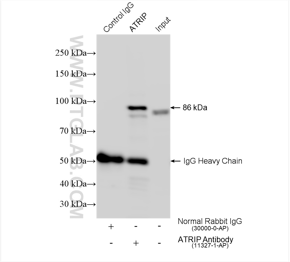 IP experiment of HeLa using 11327-1-AP