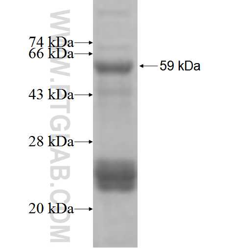 ATRIP fusion protein Ag5102 SDS-PAGE