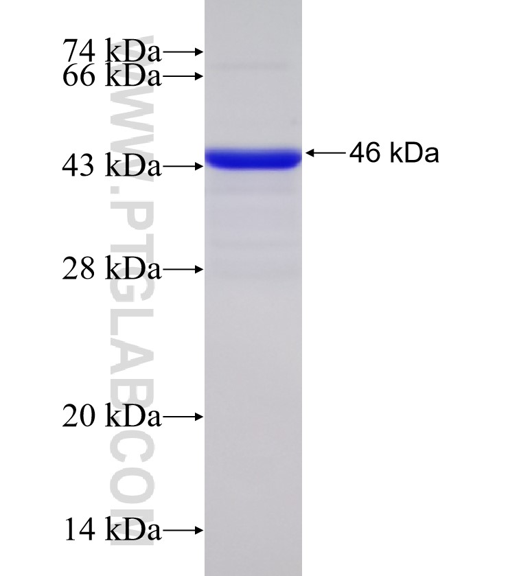 ATXN1 fusion protein Ag31136 SDS-PAGE ATXN1 fusion protein Ag31136 SDS-PAGE