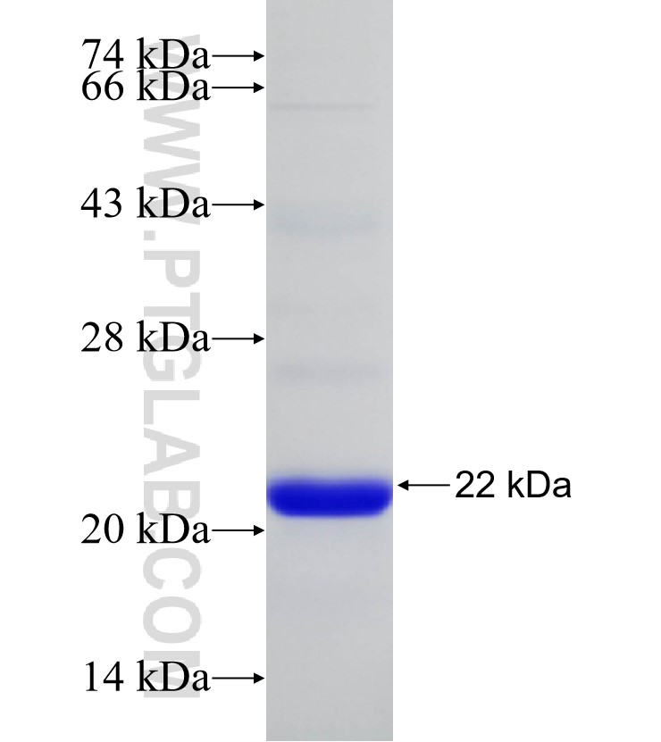 ATXN1 fusion protein Ag31160 SDS-PAGE ATXN1 fusion protein Ag31160 SDS-PAGE