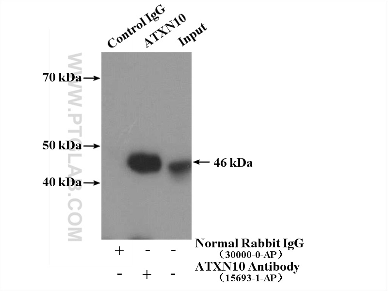 IP experiment of A431 using 15693-1-AP