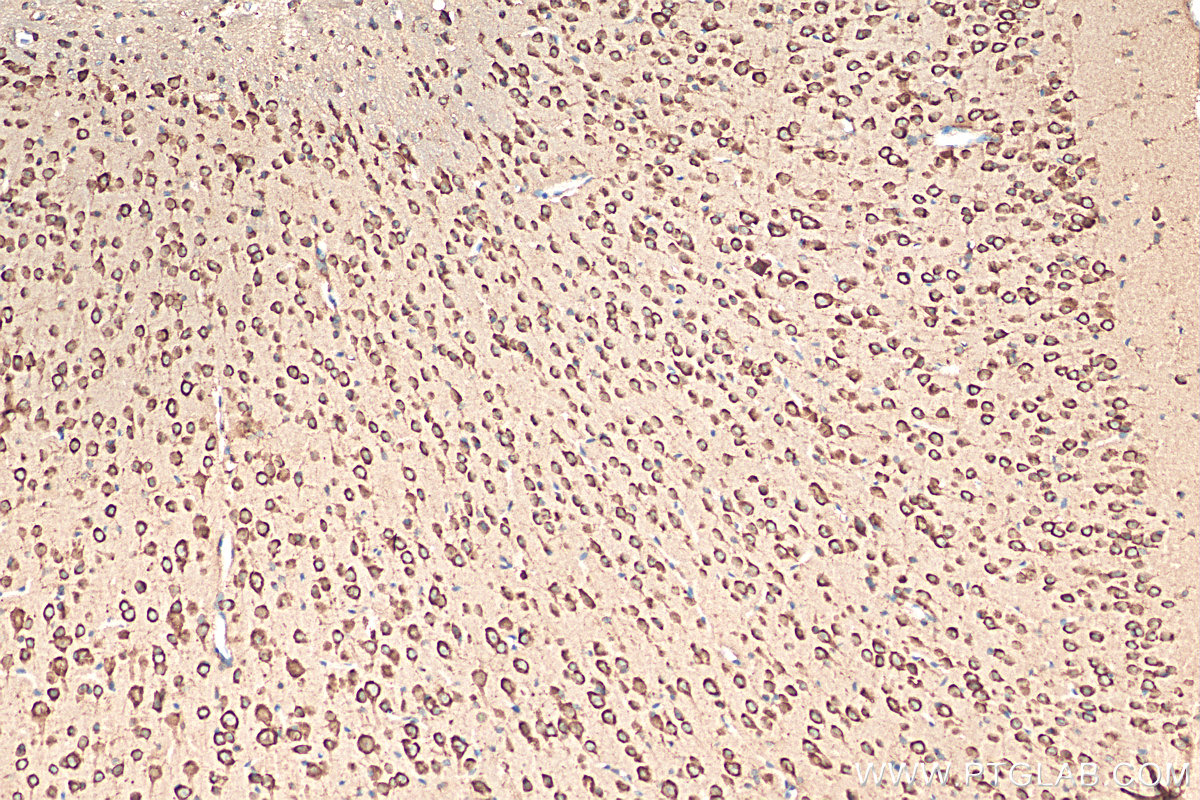 IHC staining of mouse brain using 21776-1-AP