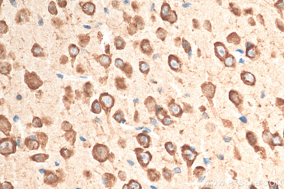 IHC staining of mouse brain using 21776-1-AP