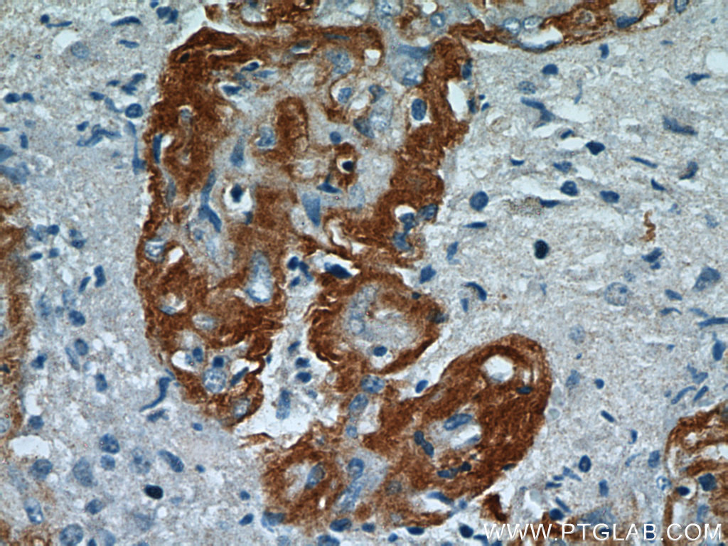 ataxin-2-antibody-21776-1-ap-proteintech