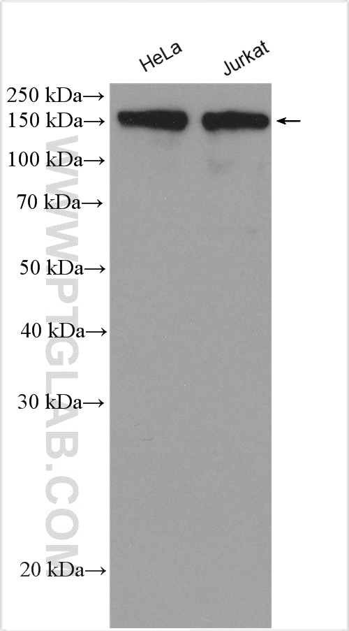 WB analysis using 21776-1-AP