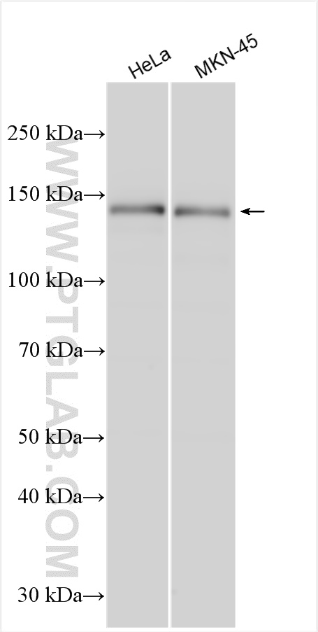 WB analysis using 24822-1-AP