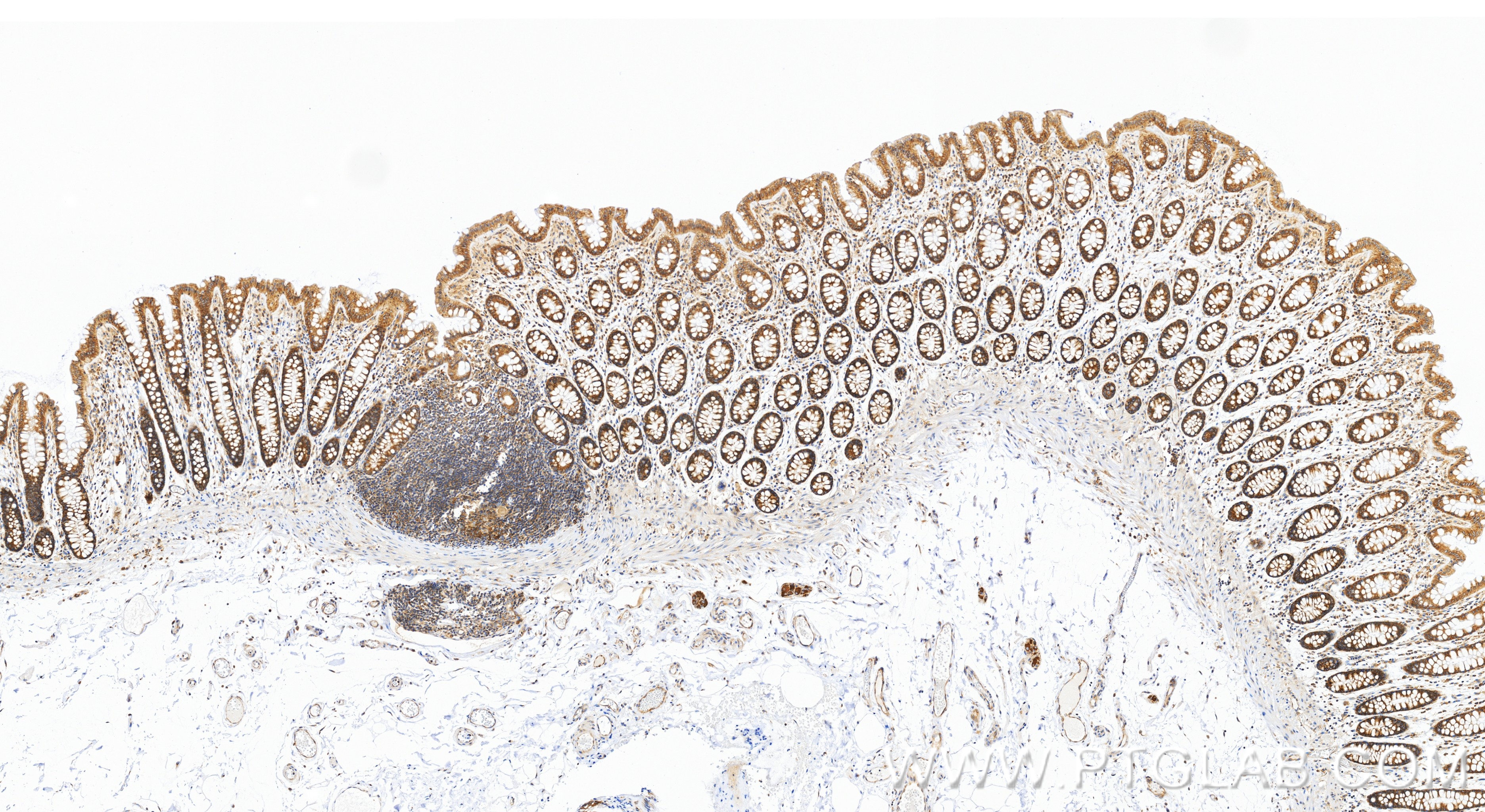 IHC staining of human colon using 86613-3-RR (same clone as 86613-3-PBS) IHC staining of human colon using 86613-3-RR (same clone as 86613-3-PBS)