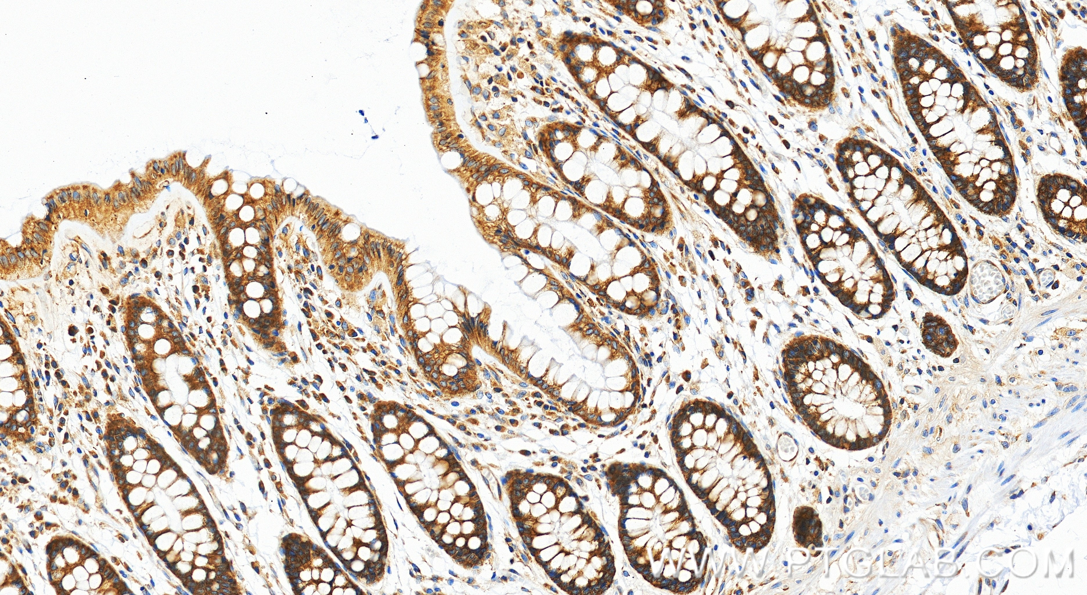 IHC staining of human colon using 86613-3-RR (same clone as 86613-3-PBS) IHC staining of human colon using 86613-3-RR (same clone as 86613-3-PBS)