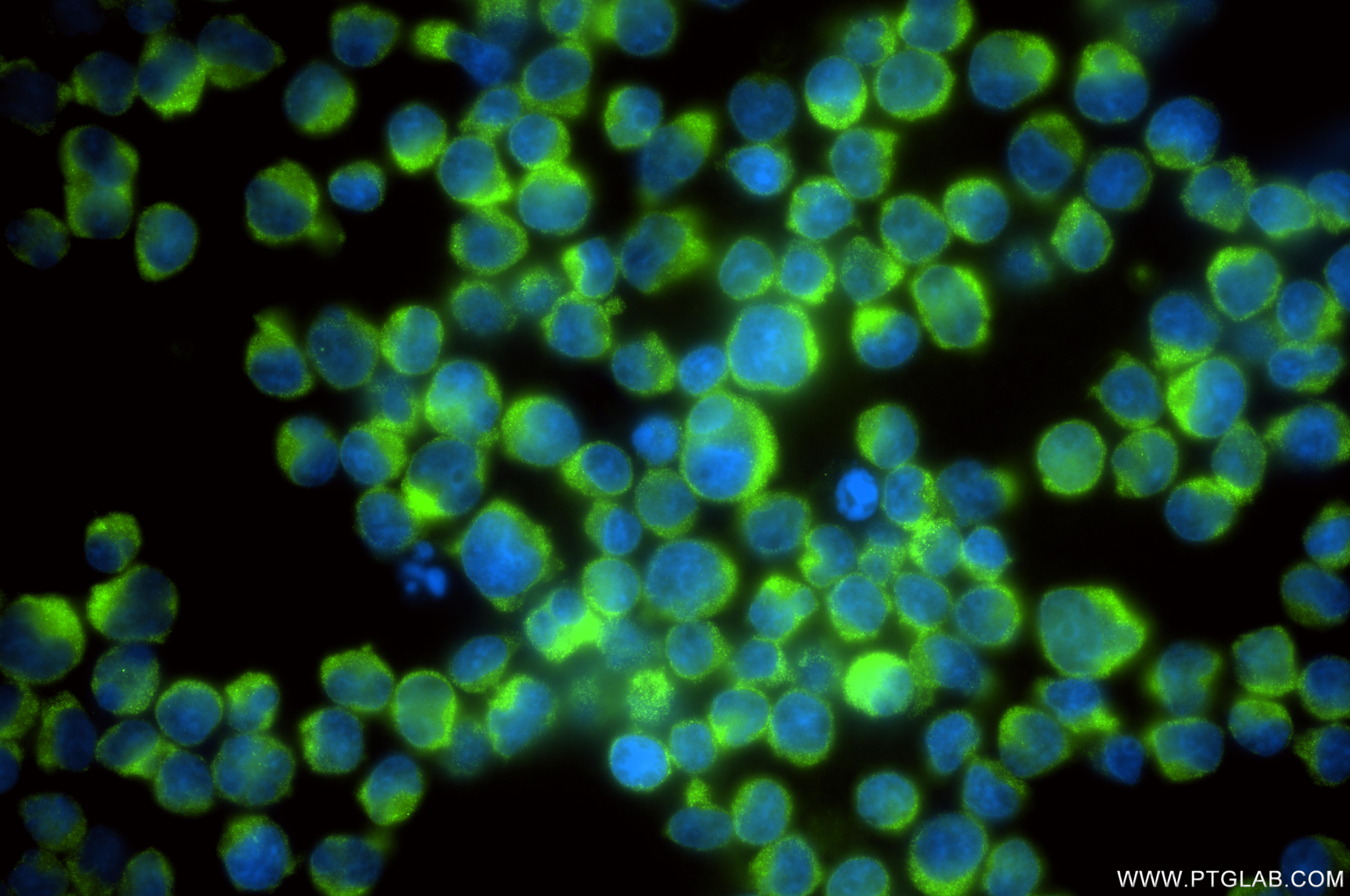 IF Staining of Jurkat using 86613-3-RR
