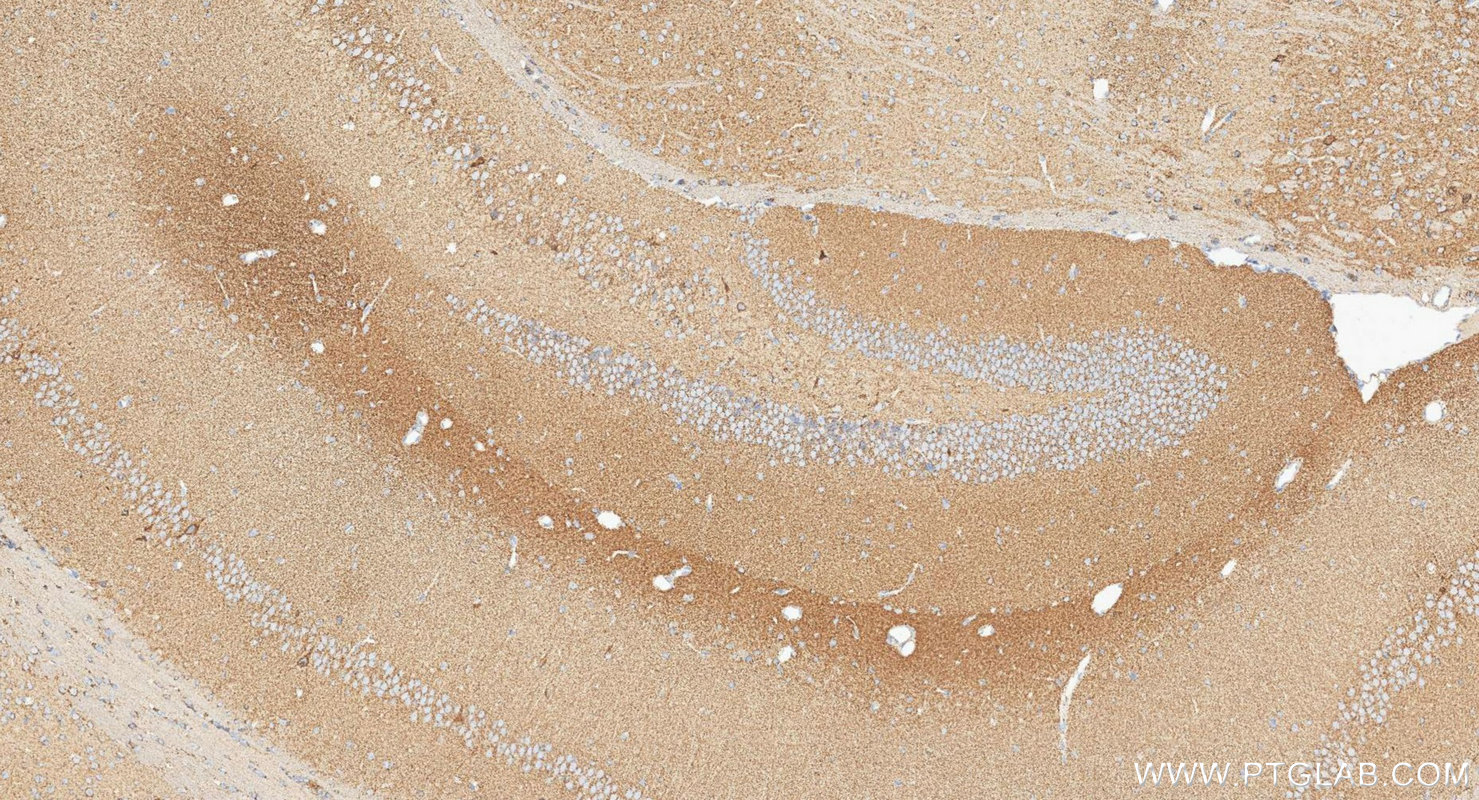 IHC staining of mouse brain using 17079-1-AP